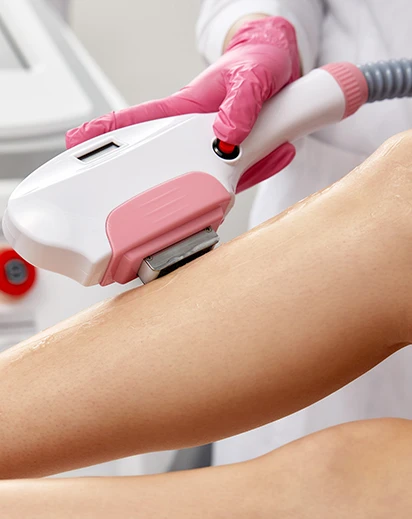 Close-up de un profesional de estética de Paola Zampetti con guantes rosas aplicando un cabezal de depilación láser en la pierna de una clienta en Torre del Mar.