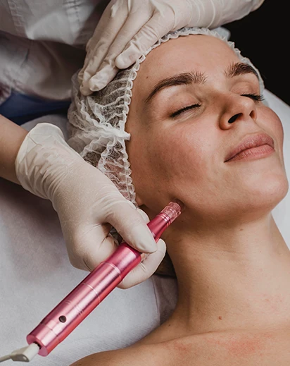 Manos con guantes blancos aplican un dispositivo de micro-needling Dermapen de color rosa en la mandíbula y el cuello de una paciente en Paola Zampetti Estética para el rejuvenecimiento facial y la estimulación de colágeno.