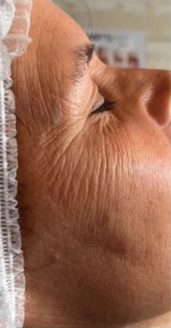 Before image